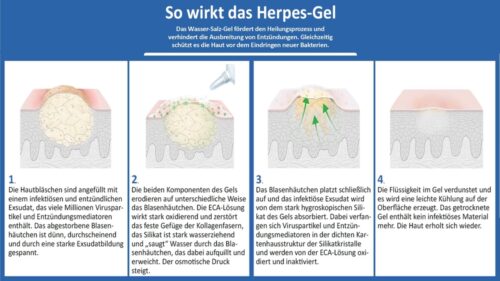 Wirkungsweise-Herpes-Gel
